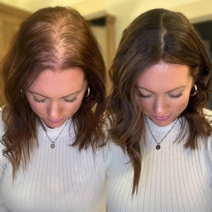 🧴🌿Advanced Hair Growth Roll-on Serum