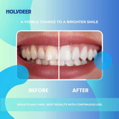 Nano-Hydroxyapatite Toothpaste, Mint, 7.5% nHAP, Fluoride-Free, Sensitive Whitening, Enamel Strengthening, 4.23 oz