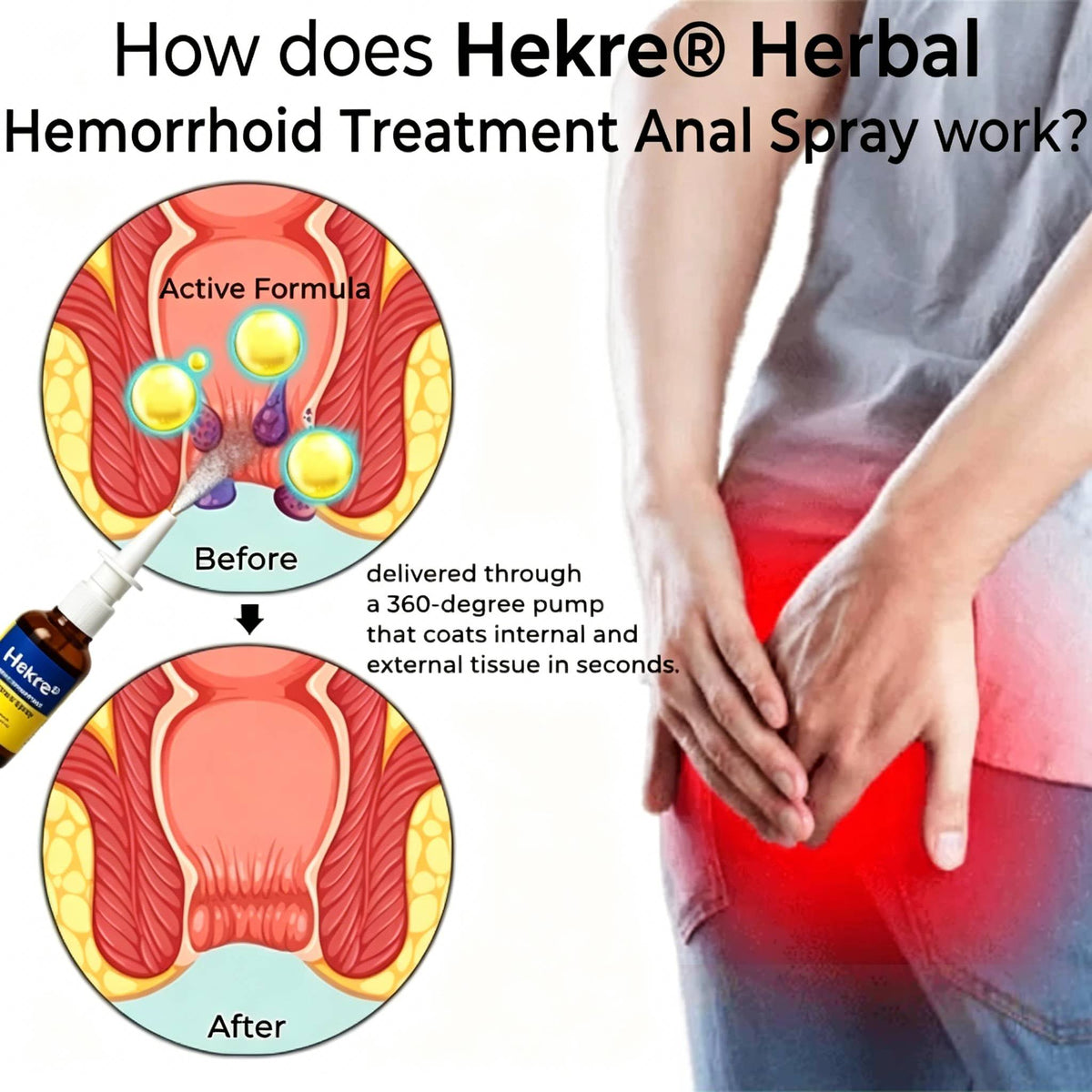 Hekre® Herbal Hemorrhoid Treatment Anal Spray Pro
