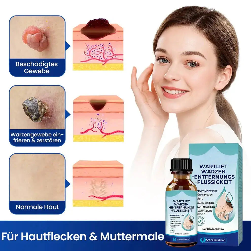 WartLift Wart Removal Fluid